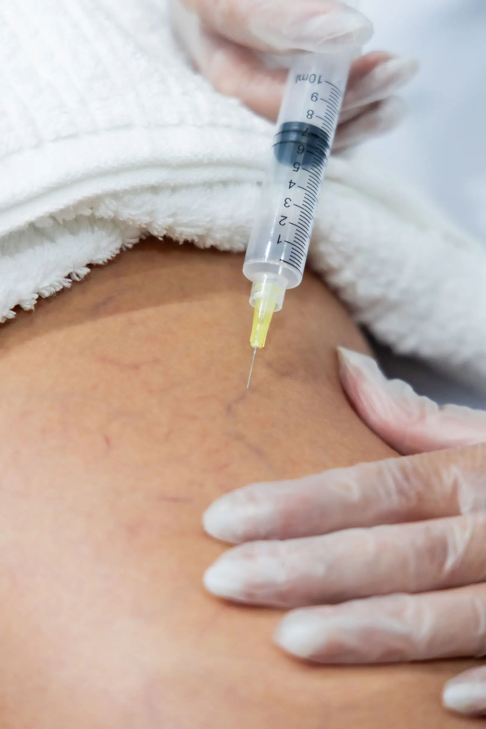 Tratamento injetável para celulite na perna
