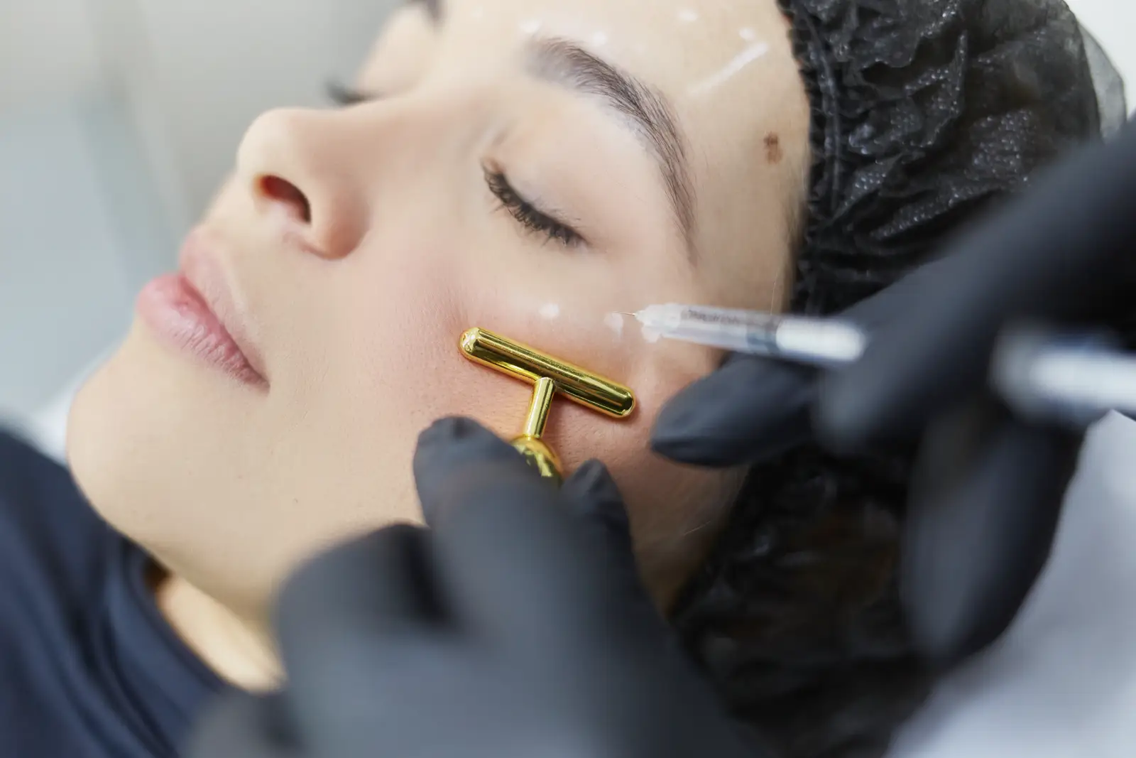 Aplicação de preenchimento facial com ácido hialurônico